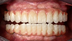 آخرین مورد شرکت پرونده مشتری. بلوک زيرکوني 4D.