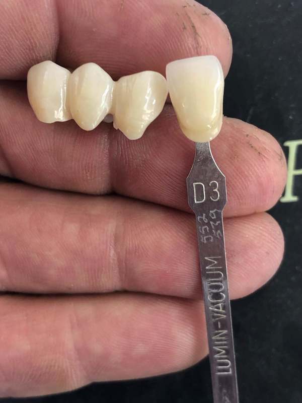 3D Plus Multilayer 43% -57% 6 Layers 3D Zirconia Dental Block Disc CAD CAM 89mm System for Dental Lab with ISO CE Certificate