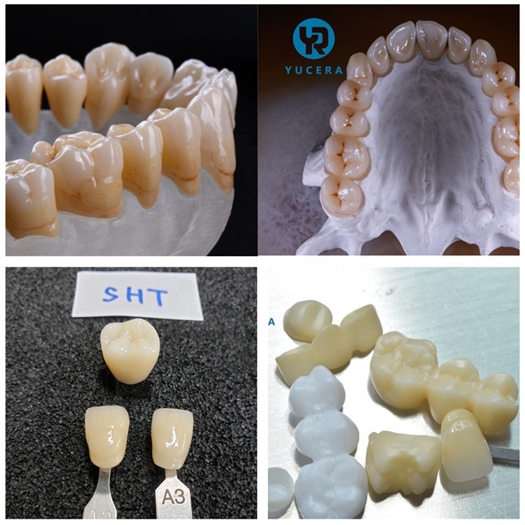Yucera Factory Price Blank Zirconia SHT Multilayer Ceramic Dentist Dental Zirconia Blocks