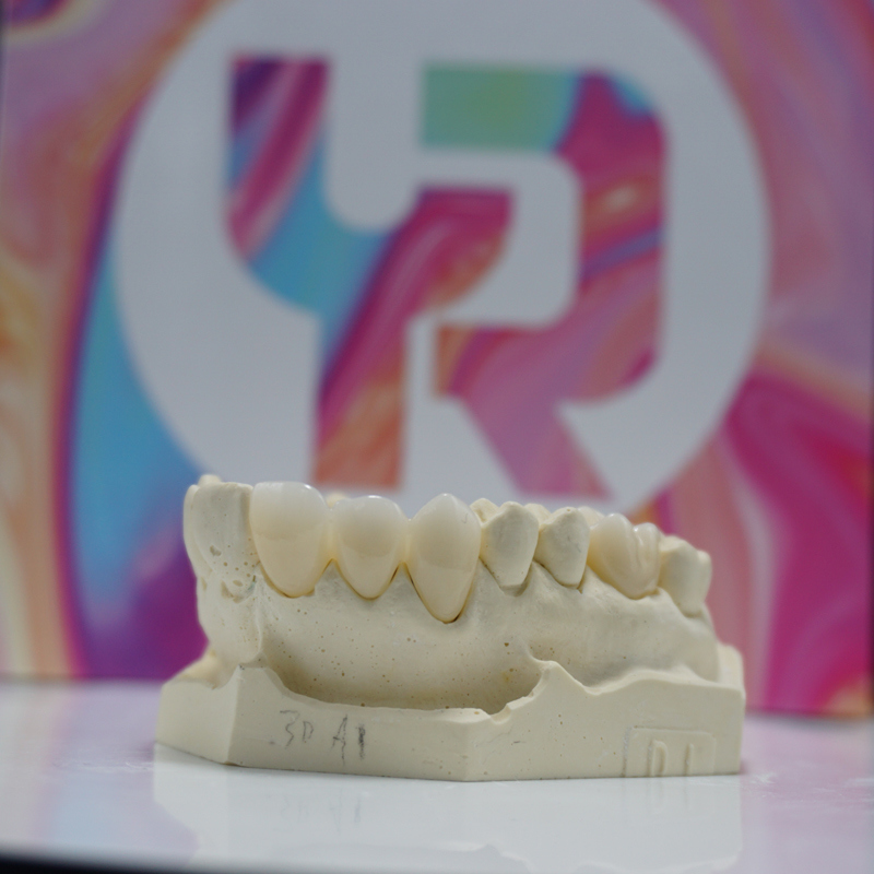 Yucera Dental All Ceramic Zirconia Block Dental Lab 4D Pro Mul-zirconia Block Translucency Dental Zirconia Disc High Quality