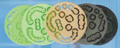 دیسک PMMA با کیفیت بالا از Yucera با خدمات OEM مواد دندانی برای لابراتوار دندانپزشکی