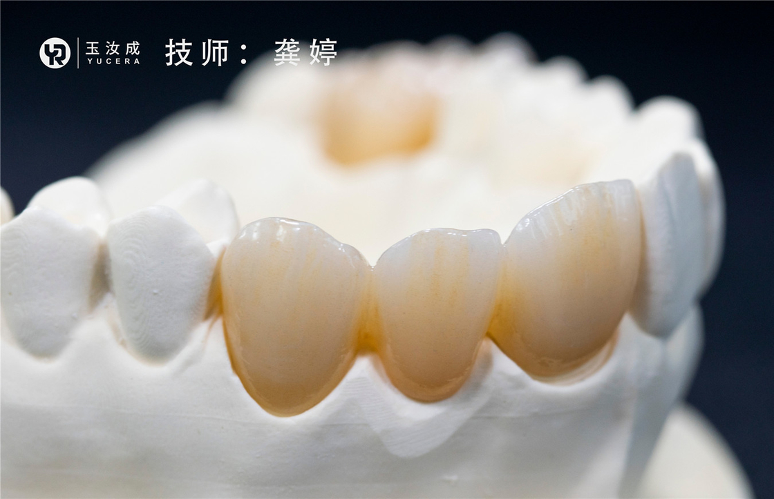 Yucera 3D Plus Multilaer بلوک زیرکونیا 98x16mm سیستم باز برای تاج پشتی